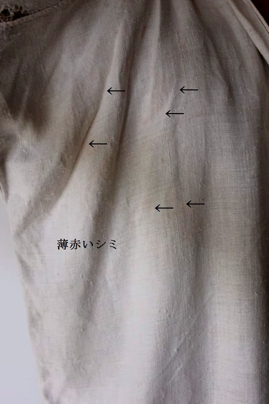 薄赤いシミ2.jpg